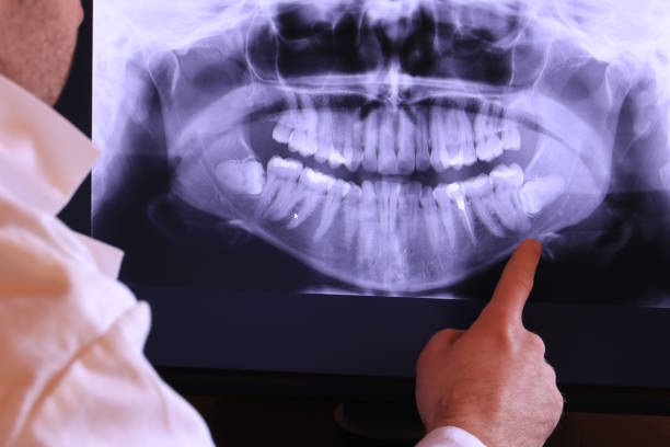 Best Emergency Tooth Extraction in Cedartown, GA